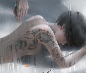 孕早期卵巢囊性占位，了解、诊断与应对策略